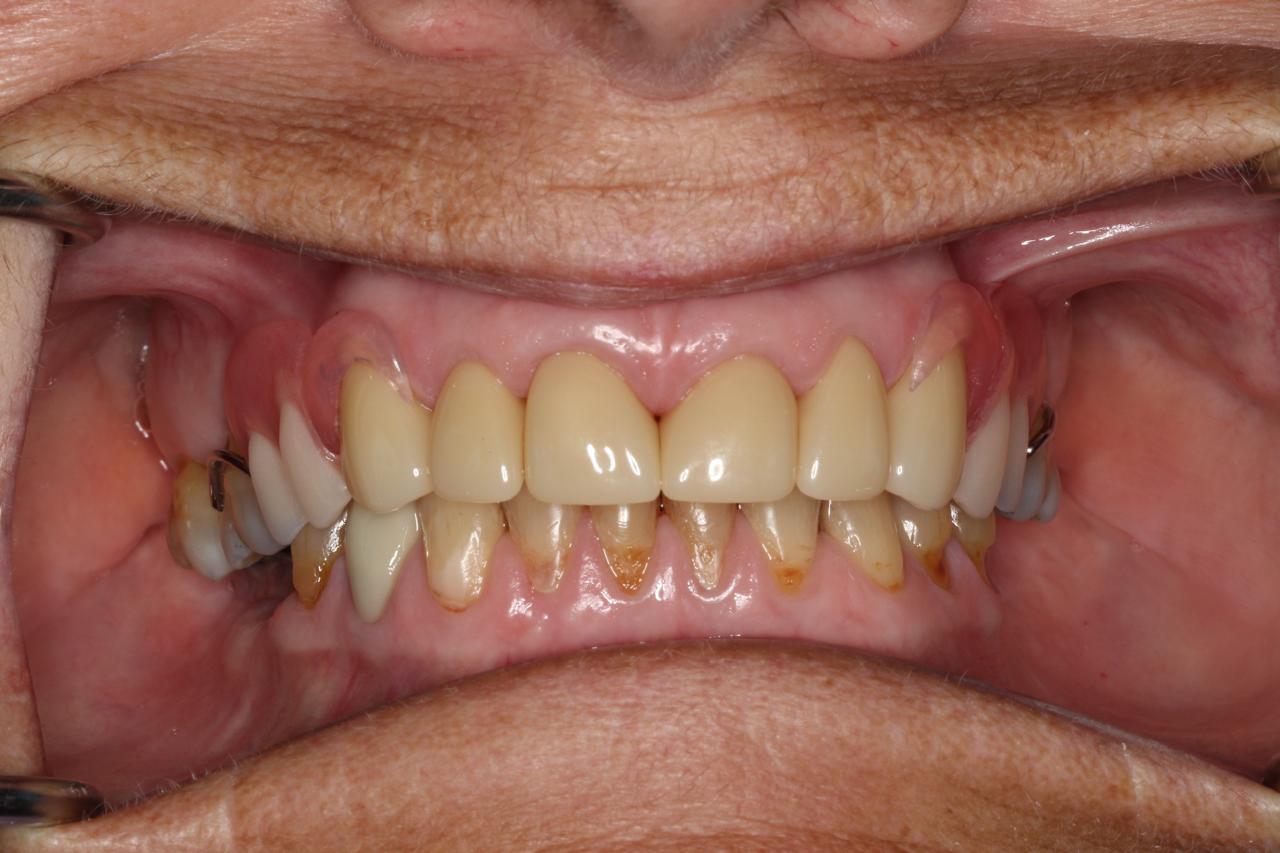 Smile gallery result 10 after treatment