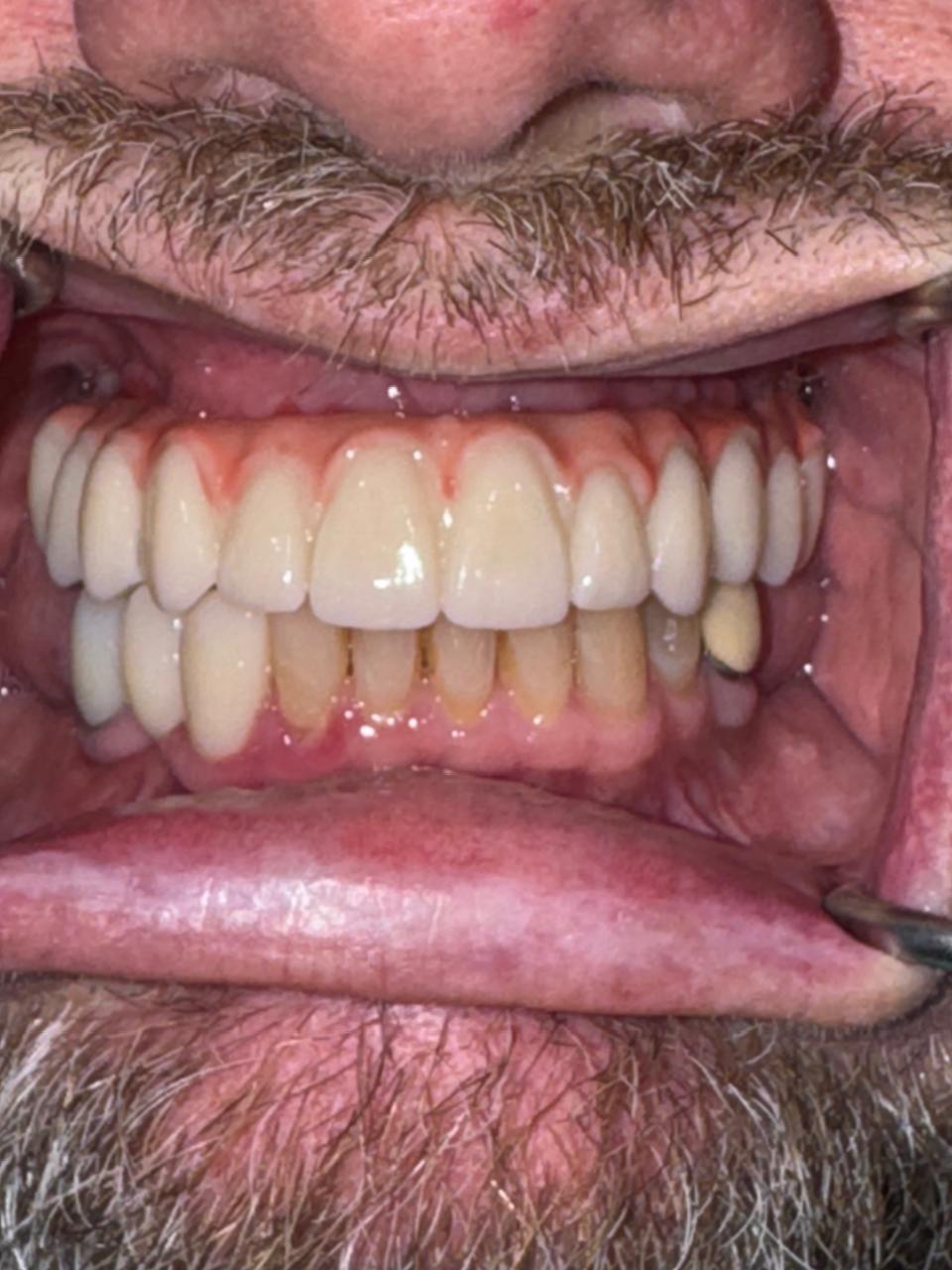 Smile gallery result 8 after treatment
