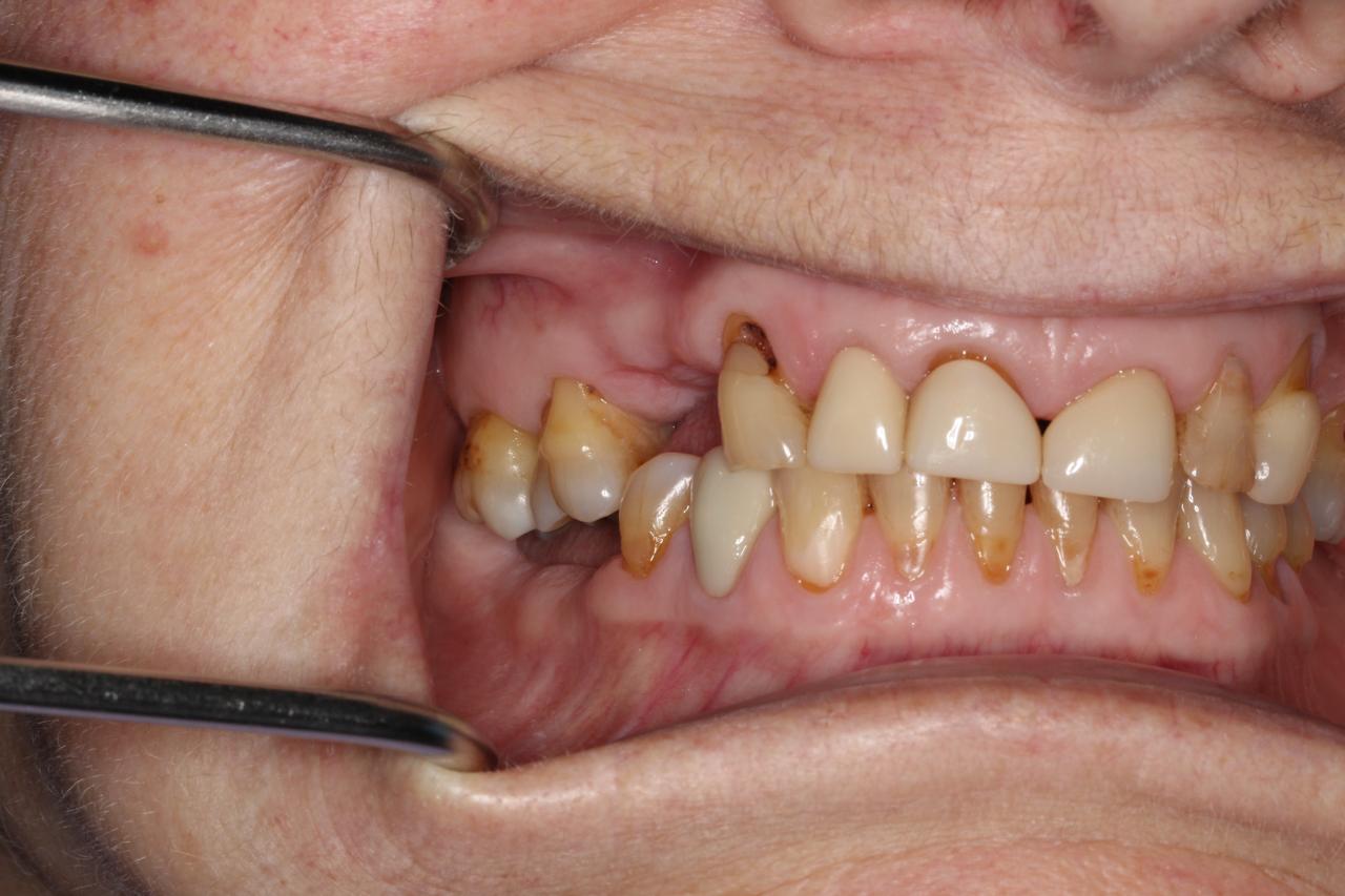 Smile gallery result 10 before treatment