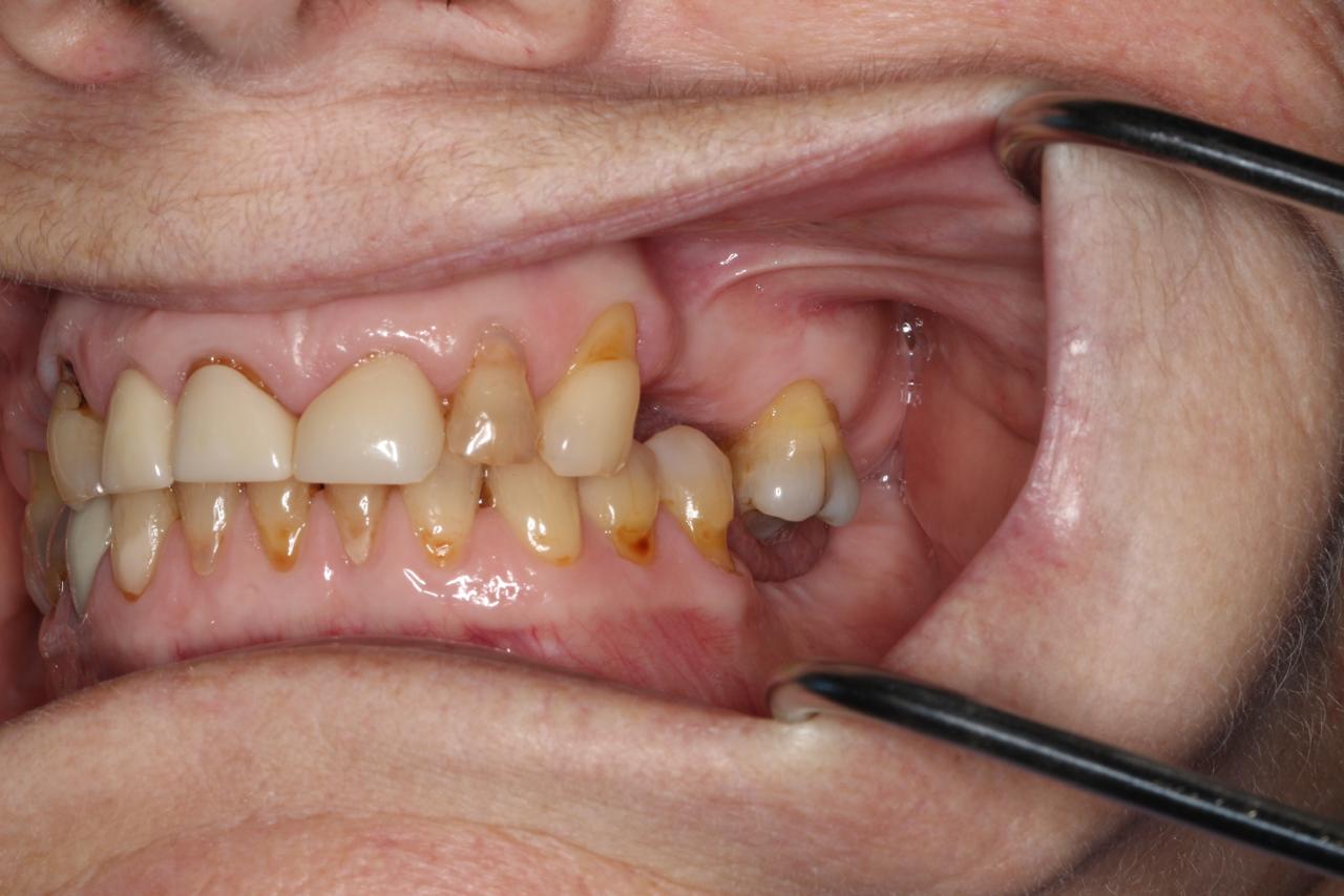 Smile gallery result 9 before treatment